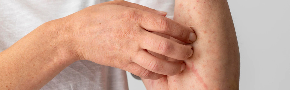 Skin-Diseases 967x300p Skin-Diseases